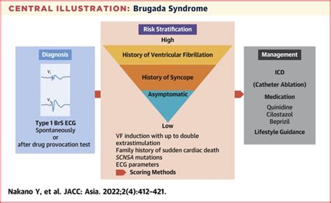 asia shimizu death|Brugada Syndrome as a Major Cause of Sudden Cardiac Death .